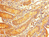 Immunohistochemistry of paraffin-embedded human small intestine tissue using CSB-PA05659A0Rb at dilution of 1:100