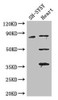 Western Blot<br />
 Positive WB detected in: SH-SY5Y whole cell lysate, Mouse heart tissue<br />
 All lanes: MAPT antibody at 3.25µg/ml<br />
 Secondary<br />
 Goat polyclonal to rabbit IgG at 1/50000 dilution<br />
 Predicted band size: 79, 37, 33, 40, 43, 41, 46, 81 kDa<br />
 Observed band size: 79, 50, 36 kDa<br />
