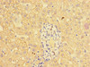 Immunohistochemistry of paraffin-embedded human liver tissue using CSB-PA11499A0Rb at dilution of 1:100