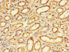 Immunohistochemistry of paraffin-embedded human renal tissue using CSB-PA15859A0Rb at dilution of 1:100