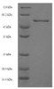 (Tris-Glycine gel) Discontinuous SDS-PAGE (reduced) with 5% enrichment gel and 15% separation gel.