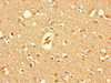 Immunohistochemistry of paraffin-embedded human brain tissue using CSB-PA603875LA01HU at dilution of 1:100