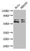 Western Blot<br />
 Positive WB detected in: Hela whole cell lysate, HEK293 whole cell lysate<br />
 All lanes: COASY antibody at 3.4µg/ml<br />
 Secondary<br />
 Goat polyclonal to rabbit IgG at 1/50000 dilution<br />
 Predicted band size: 63, 66 kDa<br />
 Observed band size: 63, 66 kDa<br />