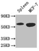 Western Blot<br />
 Positive WB detected in: Mouse spleen tissue, MCF-7 whole cell lysate<br />
 All lanes: AMPK1 antibody at 3µg/ml<br />
 Secondary<br />
 Goat polyclonal to rabbit IgG at 1/50000 dilution<br />
 Predicted band size: 65, 66 kDa<br />
 Observed band size: 65 kDa<br />