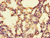 Immunohistochemistry of paraffin-embedded human lung tissue using CSB-PA618759LA01HU at dilution of 1:100