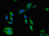 Immunofluorescent analysis of Hela cells using CSB-PA618759LA01HU at dilution of 1:100 and Alexa Fluor 488-congugated AffiniPure Goat Anti-Rabbit IgG (H+L)
