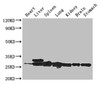 Western Blot<br />
 Positive WB detected in: Mouse heart tissue, Mouse liver tissue, Mouse spleen tissue, Mouse lung tissue, Mouse kidney tissue, Mouse brain tissue, Mouse stomach tissue<br />
 All lanes: SWI5 antibody at 3µg/ml<br />
 Secondary<br />
 Goat polyclonal to rabbit IgG at 1/50000 dilution<br />
 Predicted band size: 27 kDa<br />
 Observed band size: 27, 29 kDa<br />