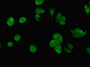 Immunofluorescent analysis of MCF-7 cells using CSB-PA636328LA01HU at dilution of 1:100 and Alexa Fluor 488-congugated AffiniPure Goat Anti-Rabbit IgG (H+L)