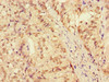 Immunohistochemistry of paraffin-embedded human adrenal gland tissue using CSB-PA705058LA01HU at dilution of 1:100