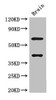 Western Blot<br />
 Positive WB detected in: Mouse brain tissue<br />
 All lanes: LRRTM4 antibody at 3µg/ml<br />
 Secondary<br />
 Goat polyclonal to rabbit IgG at 1/50000 dilution<br />
 Predicted band size: 68, 60 kDa<br />
 Observed band size: 68, 40 kDa<br /> Western Blot<br />
 Positive WB detected in: Mouse brain tissue<br />
 All lanes: LRRTM4 antibody at 3µg/ml<br />
 Secondary<br />
 Goat polyclonal to rabbit IgG at 1/50000 dilution<br />
 Predicted band size: 68, 60 kDa<br />
 Observed band size: 68, 40 kDa<br />