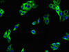Immunofluorescent analysis of HepG2 cells using CSB-PA774813LA01HU at dilution of 1:100 and Alexa Fluor 488-congugated AffiniPure Goat Anti-Rabbit IgG (H+L) Immunofluorescent analysis of HepG2 cells using CSB-PA774813LA01HU at dilution of 1:100 and Alexa Fluor 488-congugated AffiniPure Goat Anti-Rabbit IgG (H+L)