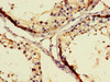 Immunohistochemistry of paraffin-embedded human testis tissue using CSB-PA818226LA01HU at dilution of 1:100