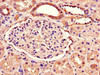 Immunohistochemistry of paraffin-embedded human kidney tissue using CSB-PA853488LA01HU at dilution of 1:100 Immunohistochemistry of paraffin-embedded human kidney tissue using CSB-PA853488LA01HU at dilution of 1:100