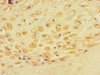 Immunohistochemistry of paraffin-embedded human placental tissue using CSB-PA878955LA01HU at dilution of 1:100