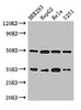Western Blot<br />
 Positive WB detected in: HEK293 whole cell lysate, HepG2 whole cell lysate, Hela whole cell lysate, U251 whole cell lysate<br />
 All lanes: LZTFL1 antibody at 3µg/ml<br />
 Secondary<br />
 Goat polyclonal to rabbit IgG at 1/50000 dilution<br />
 Predicted band size: 35, 33, 30 kDa<br />
 Observed band size: 35, 50 kDa<br />