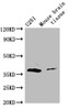 Western Blot<br />
 Positive WB detected in: Mouse brain tissue<br />
 All lanes: ADORA2B antibody at 3µg/ml<br />
 Secondary<br />
 Goat polyclonal to rabbit IgG at 1/50000 dilution<br />
 Predicted band size: 37 kDa<br />
 Observed band size: 37 kDa<br />