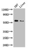 Western Blot<br />
 Positive WB detected in: U87 whole cell lysate, Mouse liver tissue<br />
 All lanes: ALDH1A3 antibody at 3µg/ml<br />
 Secondary<br />
 Goat polyclonal to rabbit IgG at 1/50000 dilution<br />
 Predicted band size: 57 kDa<br />
 Observed band size: 57 kDa<br />