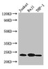 Western Blot<br />
 Positive WB detected in: Jurkat whole cell lysate, Raji whole cell lysate, THP-1 whole cell lysate<br />
 All lanes: ARHGDIB antibody at 3µg/ml<br />
 Secondary<br />
 Goat polyclonal to rabbit IgG at 1/50000 dilution<br />
 Predicted band size: 23 kDa<br />
 Observed band size: 23 kDa<br />