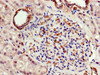 Immunohistochemistry of paraffin-embedded human kidney tissue using CSB-PA002344HA01HU at dilution of 1:100