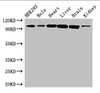 Western Blot<br />
 Positive WB detected in: HEK293 whole cell lysate, Hela whole cell lysate, Mouse heart tissue, Mouse liver tissue, Mouse brain tissue, Mouse kidney tissue<br />
 All lanes: CDH2 antibody at 3µg/ml<br />
 Secondary<br />
 Goat polyclonal to rabbit IgG at 1/50000 dilution<br />
 Predicted band size: 100, 98 kDa<br />
 Observed band size: 100 kDa<br />