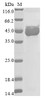 (Tris-Glycine gel) Discontinuous SDS-PAGE (reduced) with 5% enrichment gel and 15% separation gel.