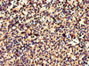 Immunohistochemistry of paraffin-embedded human spleen tissue using CSB-PA005679LA01HU at dilution of 1:100