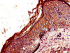 Immunohistochemistry of paraffin-embedded human skin tissue using CSB-PA005679LA01HU at dilution of 1:100