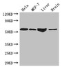 Western Blot<br />
 Positive WB detected in: Hela whole cell lysate, MCF-7 whole cell lysate, Mouse liver tissue, Mouse brain tissue<br />
 All lanes: ETS2 antibody at 2.7µg/ml<br />
 Secondary<br />
 Goat polyclonal to rabbit IgG at 1/50000 dilution<br />
 Predicted band size: 54 kDa<br />
 Observed band size: 54 kDa<br />
