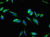 Immunofluorescent analysis of Hela cells using CSB-PA007936LA01HU at dilution of 1:100 and Alexa Fluor 488-congugated AffiniPure Goat Anti-Rabbit IgG (H+L)