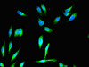 Immunofluorescent analysis of Hela cells using CSB-PA008642LA01HU at dilution of 1:100 and Alexa Fluor 488-congugated AffiniPure Goat Anti-Rabbit IgG (H+L)