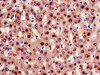 Immunohistochemistry of paraffin-embedded human liver tissue using CSB-PA009316LA01HU at dilution of 1:100