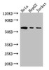 Western Blot<br />
 Positive WB detected in: Hela whole cell lysate, HepG2 whole cell lysate, Jurkat whole cell lysate<br />
 All lanes: HPSE antibody at 3µg/ml<br />
 Secondary<br />
 Goat polyclonal to rabbit IgG at 1/50000 dilution<br />
 Predicted band size: 62, 55, 54, 43 kDa<br />
 Observed band size: 62 kDa<br />