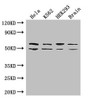 Western Blot<br />
 Positive WB detected in: Hela whole cell lysate, K562 whole cell lysate, HEK293 whole cell lysate, Mouse brain tissue<br />
 All lanes: IGF2BP3 antibody at 2µg/ml<br />
 Secondary<br />
 Goat polyclonal to rabbit IgG at 1/50000 dilution<br />
 Predicted band size: 64, 22 kDa<br />
 Observed band size: 64, 50 kDa<br />