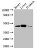 Western Blot<br />
 Positive WB detected in: Mouse heart tissue, Mouse liver tissue, Mouse stomach tissue<br />
 All lanes: LANCL1 antibody at 3µg/ml<br />
 Secondary<br />
 Goat polyclonal to rabbit IgG at 1/50000 dilution<br />
 Predicted band size: 46 kDa<br />
 Observed band size: 46 kDa<br />