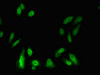 Immunofluorescent analysis of Hela cells using CSB-PA012975LA01HU at dilution of 1:100 and Alexa Fluor 488-congugated AffiniPure Goat Anti-Rabbit IgG (H+L)