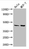 Western Blot<br />
 Positive WB detected in: Hela whole cell lysate, MCF-7 whole cell lysate<br />
 All lanes: MAP2K4 antibody at 3.25µg/ml<br />
 Secondary<br />
 Goat polyclonal to rabbit IgG at 1/50000 dilution<br />
 Predicted band size: 45, 46 kDa<br />
 Observed band size: 45 kDa<br />