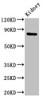 Western Blot<br />
 Positive WB detected in: Rat kidney tissue<br />
 All lanes: MFN2 antibody at 3µg/ml<br />
 Secondary<br />
 Goat polyclonal to rabbit IgG at 1/50000 dilution<br />
 Predicted band size: 89, 51 kDa<br />
 Observed band size: 89 kDa<br /> Western Blot<br />
 Positive WB detected in: Rat kidney tissue<br />
 All lanes: MFN2 antibody at 3µg/ml<br />
 Secondary<br />
 Goat polyclonal to rabbit IgG at 1/50000 dilution<br />
 Predicted band size: 89, 51 kDa<br />
 Observed band size: 89 kDa<br />