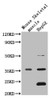 Western Blot<br />
 Positive WB detected in: Mouse heart tissue, Mouse liver tissue, Mouse kidney tissue, Mouse brain tissue, Mouse skeletal muscle tissue, Mouse stomach tissue<br />
 All lanes: MTND1 antibody at 3µg/ml<br />
 Secondary<br />
 Goat polyclonal to rabbit IgG at 1/50000 dilution<br />
 Predicted band size: 36 kDa<br />
 Observed band size: 36 kDa<br />