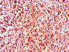 Immunohistochemistry of paraffin-embedded human pancreatic tissue using CSB-PA015249LA01HU at dilution of 1:100