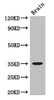 Western Blot<br />
 Positive WB detected in: Mouse brain tissue<br />
 All lanes: MYOD1 antibody at 3µg/ml<br />
 Secondary<br />
 Goat polyclonal to rabbit IgG at 1/50000 dilution<br />
 Predicted band size: 35 kDa<br />
 Observed band size: 35 kDa<br />
