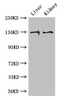 Western Blot<br />
 Positive WB detected in: Mouse liver tissue, Mouse kidney tissue<br />
 All lanes: PC antibody at 3µg/ml<br />
 Secondary<br />
 Goat polyclonal to rabbit IgG at 1/50000 dilution<br />
 Predicted band size: 130, 58 kDa<br />
 Observed band size: 130 kDa<br />