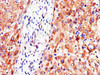 Immunohistochemistry of paraffin-embedded human liver tissue using CSB-PA017511LA01HU at dilution of 1:100