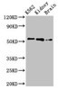 Western Blot<br />
 Positive WB detected in: K562 whole cell lysate, Rat kidney tissue, Rat brain tissue<br />
 All lanes: PFKFB2 antibody at 3µg/ml<br />
 Secondary<br />
 Goat polyclonal to rabbit IgG at 1/50000 dilution<br />
 Predicted band size: 59, 55 kDa<br />
 Observed band size: 55 kDa<br />