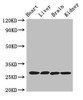 Western Blot<br />
 Positive WB detected in: Mouse heart tissue, Mouse liver tissue, Mouse brain tissue, Mouse kidney tissue<br />
 All lanes: PRSS2 antibody at 3µg/ml<br />
 Secondary<br />
 Goat polyclonal to rabbit IgG at 1/50000 dilution<br />
 Predicted band size: 27 kDa<br />
 Observed band size: 27 kDa<br />