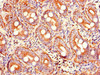 Immunohistochemistry of paraffin-embedded human small intestine tissue using CSB-PA018814LA01HU at dilution of 1:100