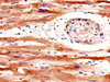 IHC image of CSB-PA021138LA01HU diluted at 1:600 and staining in paraffin-embedded human heart tissue performed on a Leica BondTM system. After dewaxing and hydration, antigen retrieval was mediated by high pressure in a citrate buffer (pH 6.0) . Section was blocked with 10% normal goat serum 30min at RT. Then primary antibody (1% BSA) was incubated at 4°C overnight. The primary is detected by a biotinylated secondary antibody and visualized using an HRP conjugated SP system.