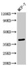 Western Blot<br />
 Positive WB detected in: MCF-7 whole cell lysate<br />
 All lanes: SFRP4 antibody at 3µg/ml<br />
 Secondary<br />
 Goat polyclonal to rabbit IgG at 1/50000 dilution<br />
 Predicted band size: 40 kDa<br />
 Observed band size: 40 kDa<br />