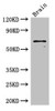 Western Blot<br />
 Positive WB detected in: Mouse brain tissue<br />
 All lanes: SLC6A3 antibody at 3µg/ml<br />
 Secondary<br />
 Goat polyclonal to rabbit IgG at 1/50000 dilution<br />
 Predicted band size: 69 kDa<br />
 Observed band size: 69 kDa<br />