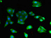 Immunofluorescent analysis of HepG2 cells using CSB-PA023608LA01HU at dilution of 1:100 and Alexa Fluor 488-congugated AffiniPure Goat Anti-Rabbit IgG (H+L)