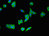 Immunofluorescent analysis of HepG2 cells using CSB-PA026141LA01HU at dilution of 1:100 and Alexa Fluor 488-congugated AffiniPure Goat Anti-Rabbit IgG (H+L)